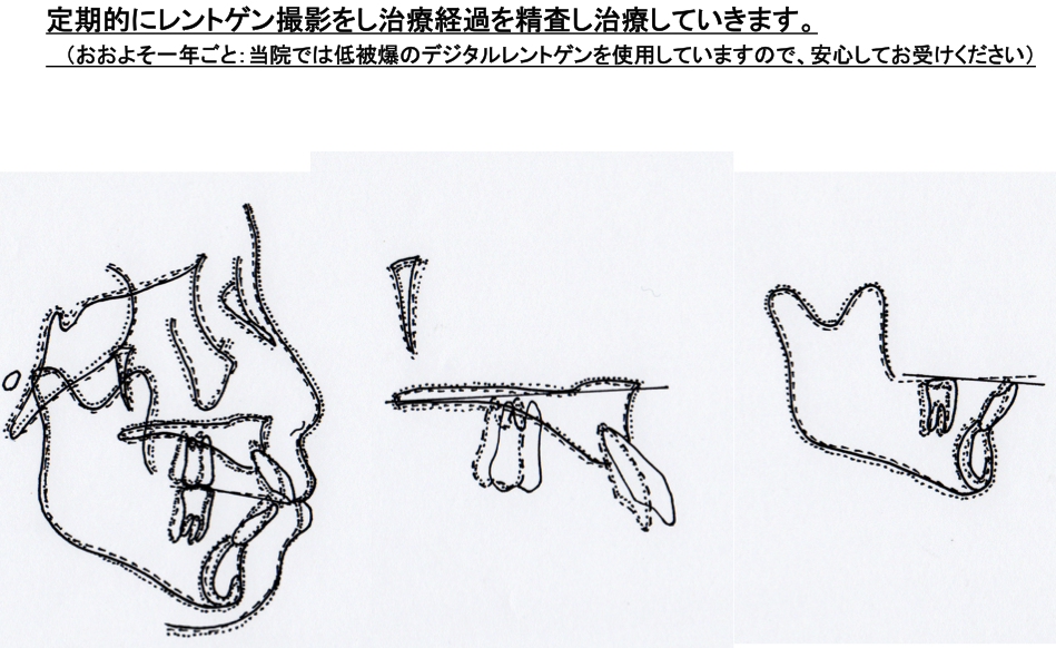 検査・診断_3